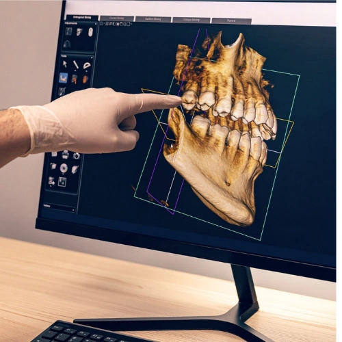 Digital Dental X-rays