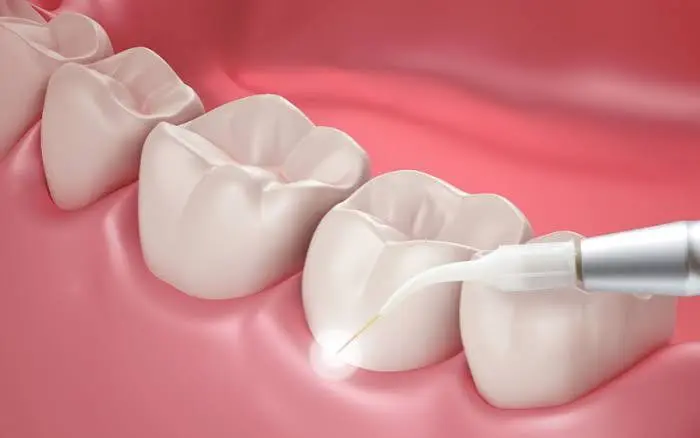 Gum & Periodontal Care