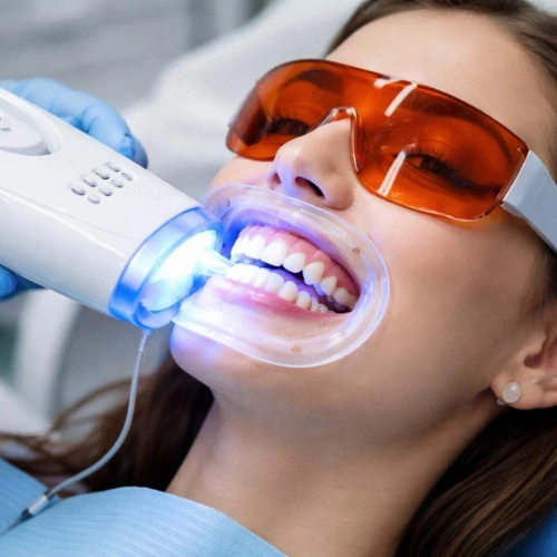Professional Teeth Whitening
