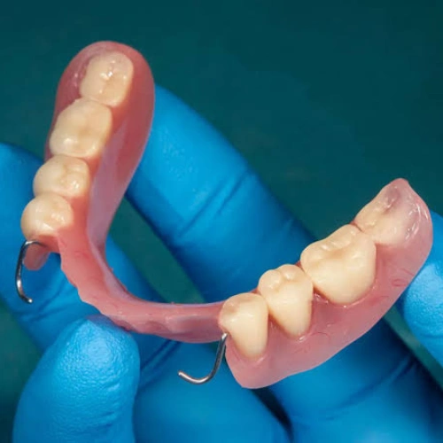 Removable Dentures